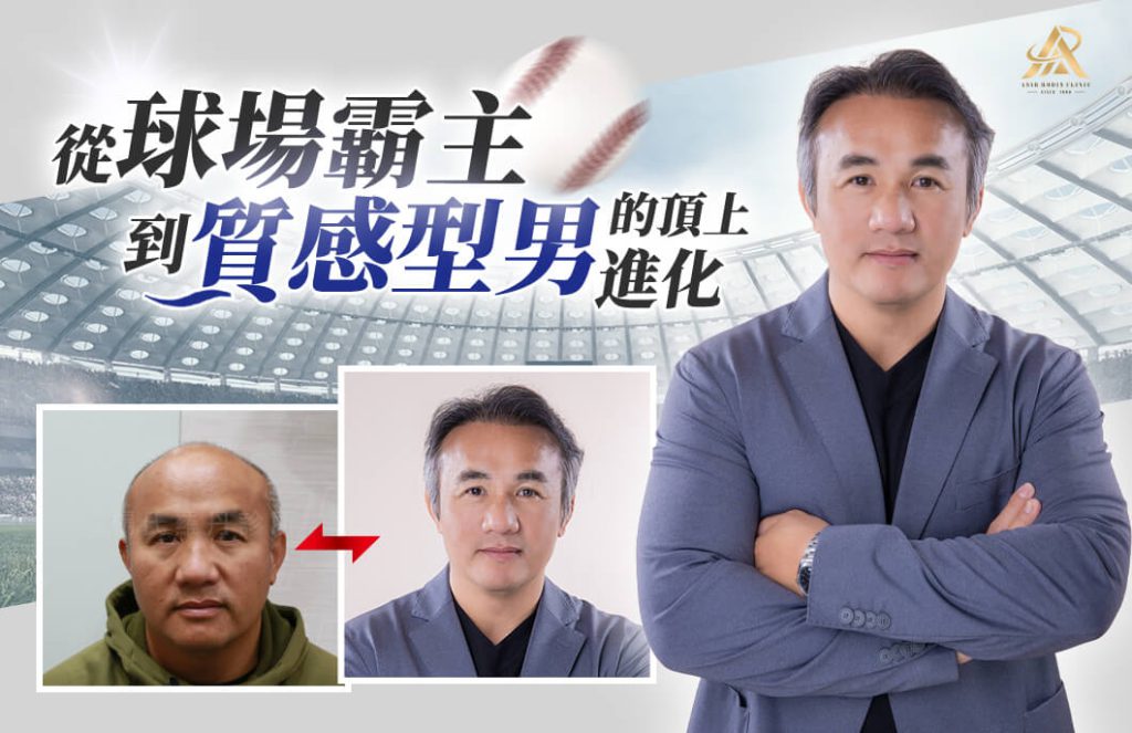 張泰山_前植後泌_楊氏羅丹_掉髮_植髮